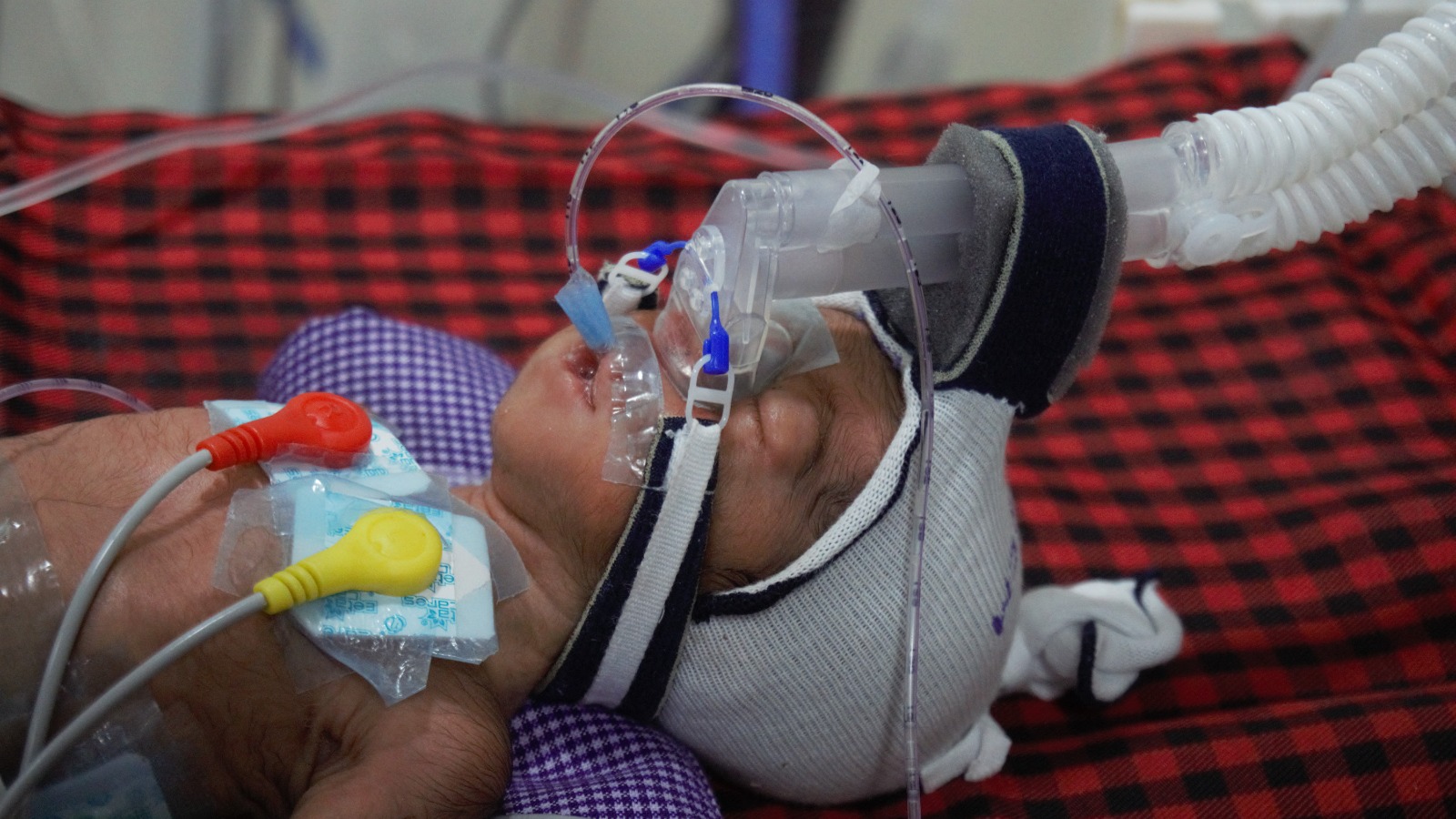NICU